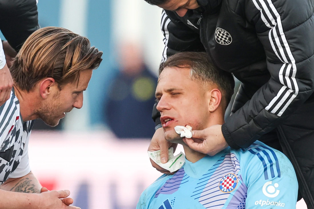 Ozlijeđeni vratar Hajduka Ivan Lučić