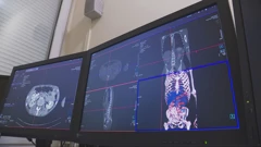 Bolnica u Našicama dobiva magnetsku rezonanciju  