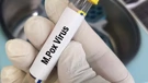 Majmunske boginje više nisu međunarodna zdravstvena kriza