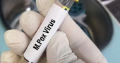 Majmunske boginje više nisu međunarodna zdravstvena kriza