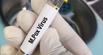 Majmunske boginje više nisu međunarodna zdravstvena kriza