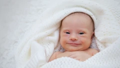 Novorođenče s Downovim sindromom