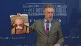 Škoro održao konferenciju povodom incidenta