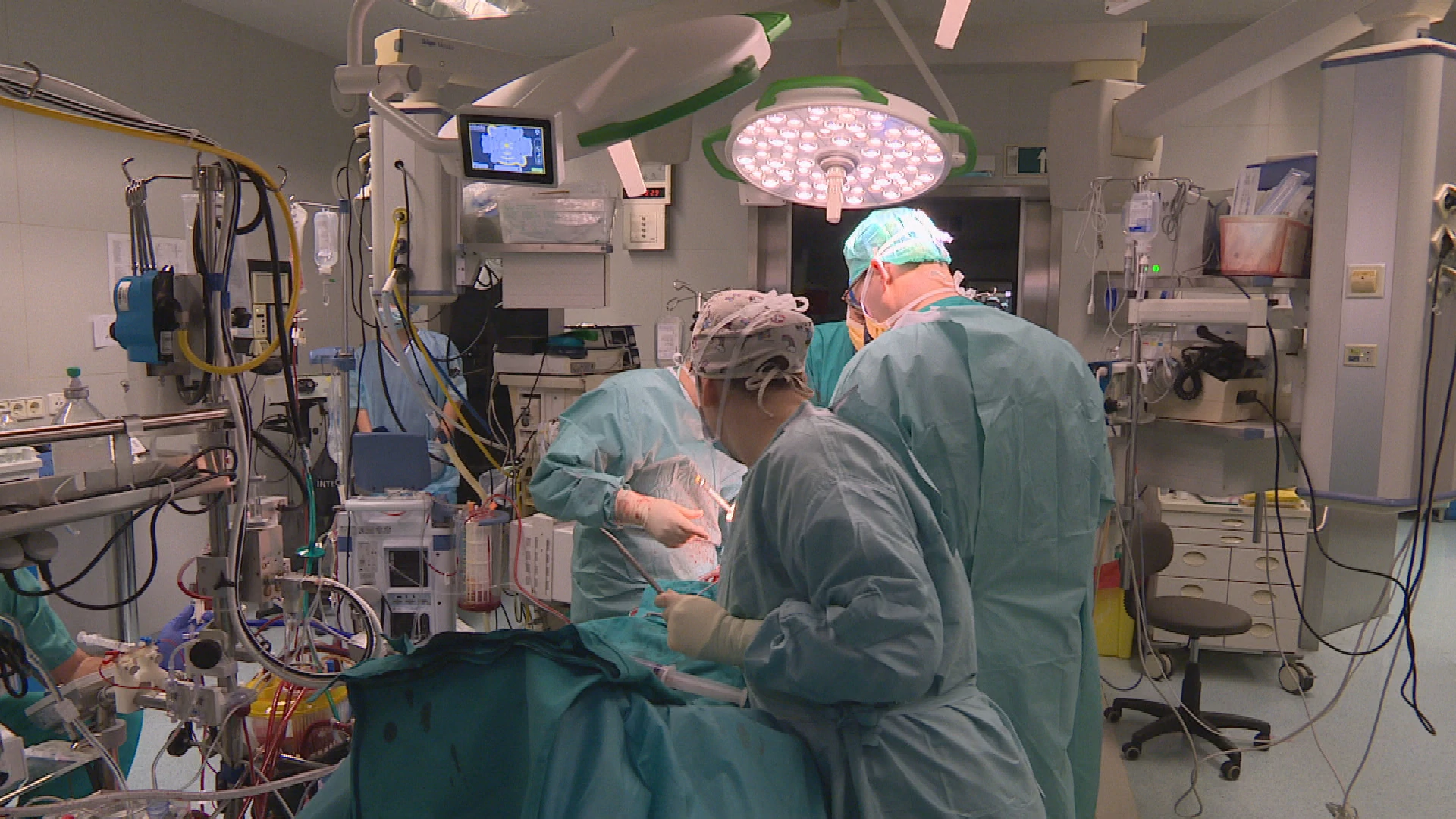 operacija rebro frame 1548 20241204184623