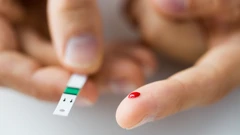 Uslijed gubitka težine dijabetes tipa 2 može biti u remisiji pet godina