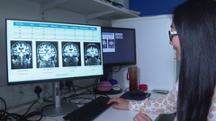 AI i Alzheimer
