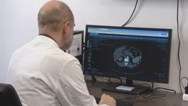 Mjesec borbe protiv raka gušterače