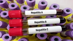 Hepatitis, ilustracija