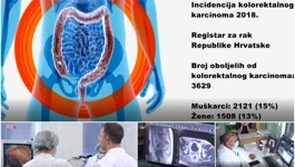 Zašto je broj karcinoma u porastu?