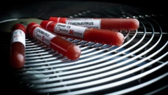 Koronavirus u Sloveniji