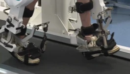 U Varaždinskim Toplicama robot pomaže pacijentima
