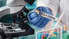 U Hrvatskoj 3.860 novozaraženih koronavirusom