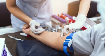 Napredni test krvi 