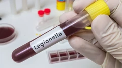 Legionarska bolest