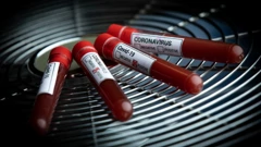 Testiranje na koronavirus