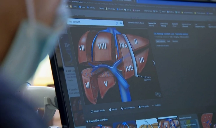 Priprema za transplantaciju