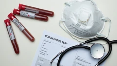 Testiranje na koronavirus 