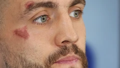 Mateo Kovačić s masnicama
