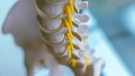 Spina bifida