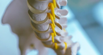 Spina bifida