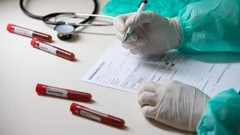 Testiranje na koronavirus