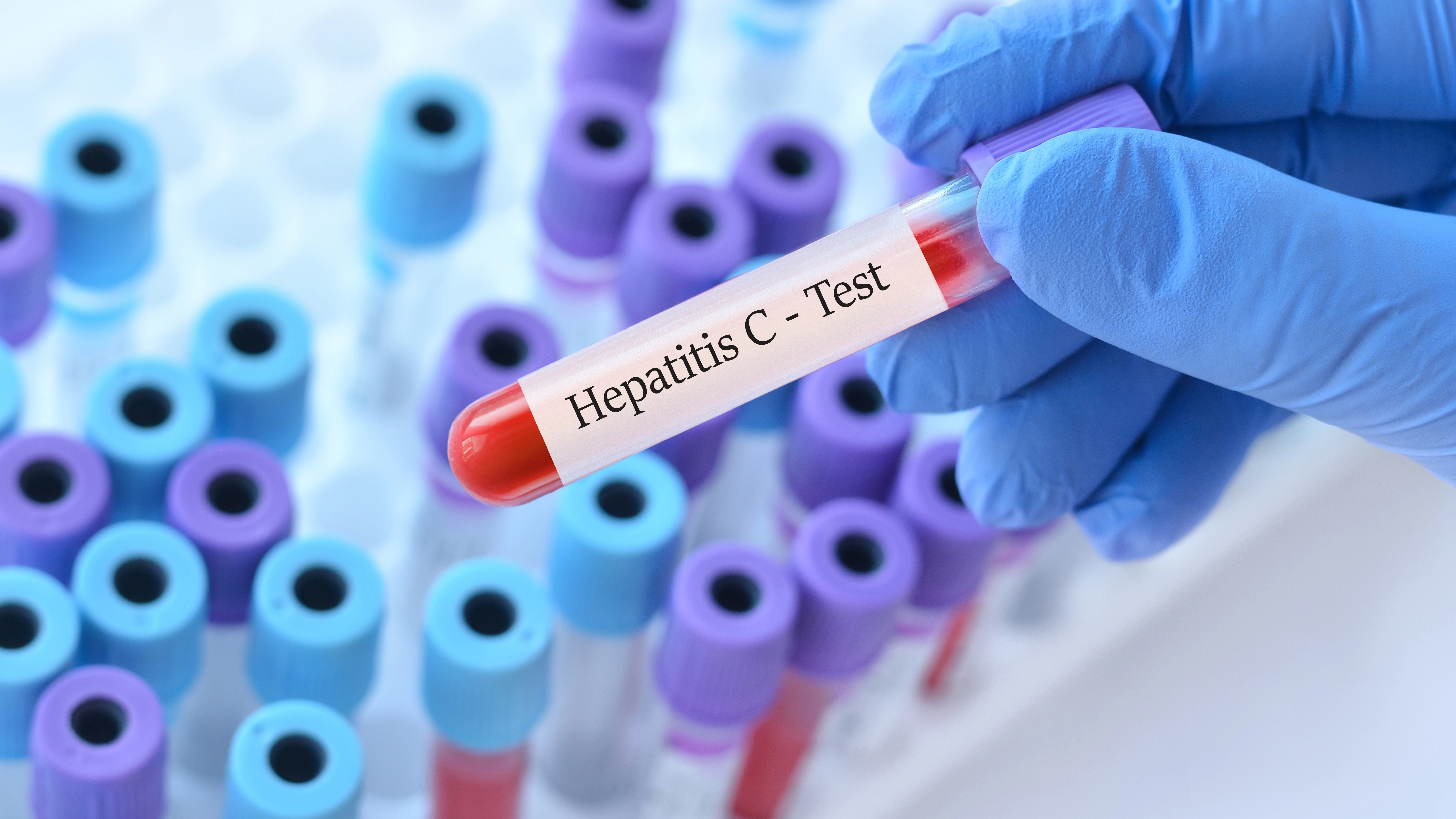 Testiranja na hepatitis C 