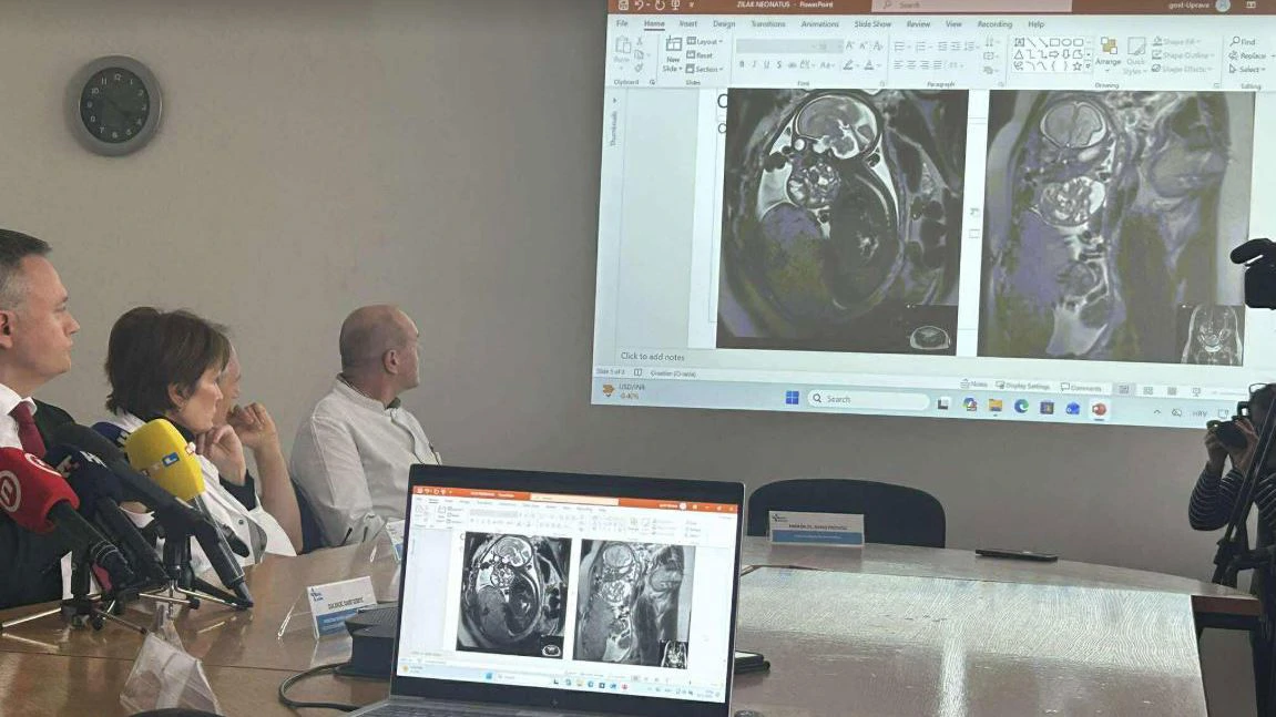 Operacija na bebi staroj tek dva sata, Foto: Ruža Ištuk/HTV