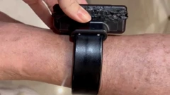 Narukvica s elektroničkim nadzorom