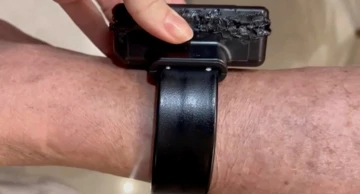 Narukvica s elektroničkim nadzorom