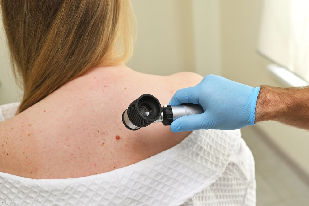 Novo otkriće s IRB-a o kretanju stanica melanoma
