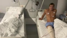 Matej Nevešćanin, započeo proces rehabilitacije nakon operacije