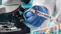 Koronavirus: 907 novozaraženih, 10 preminulih