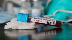 Slovenija opet s rastom epidemije