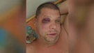 Napadači u Rijeci pretukli mladića s invaliditetom