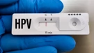 HPV test
