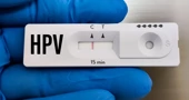 HPV test