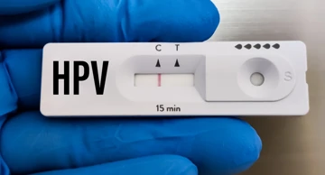 HPV test