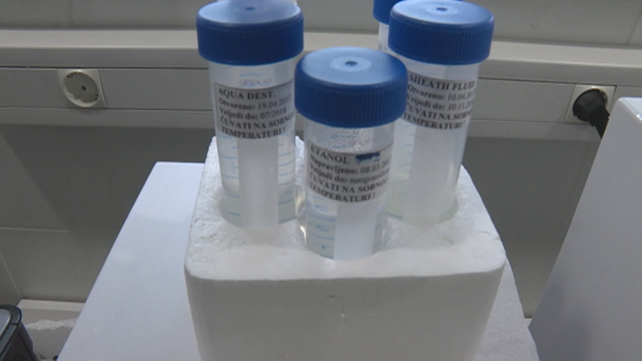 Odjel za hematologiju - KBC Zagreb, Foto: HTV/HRT