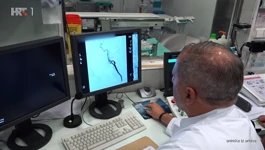 Bolest perifernih arterija BPA