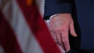 Modrica na Trumpovoj ruci