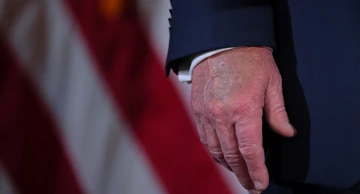 Modrica na Trumpovoj ruci