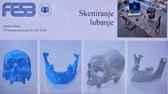Postupak rekonstrukcije lica, Foto: H. Gunjača/HRT