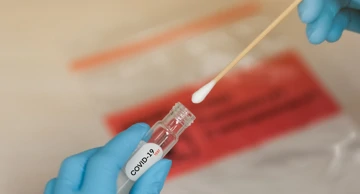 Ljekarne i ordinacije bilježe porast broja COVID-19 slučajeva